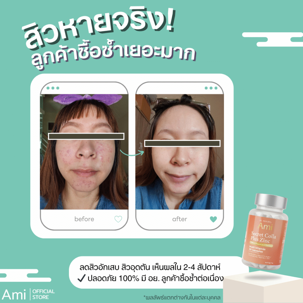อาหารเสริม Ami Secret Colla Plus Zinc บำรุงผิว กระจ่างใส