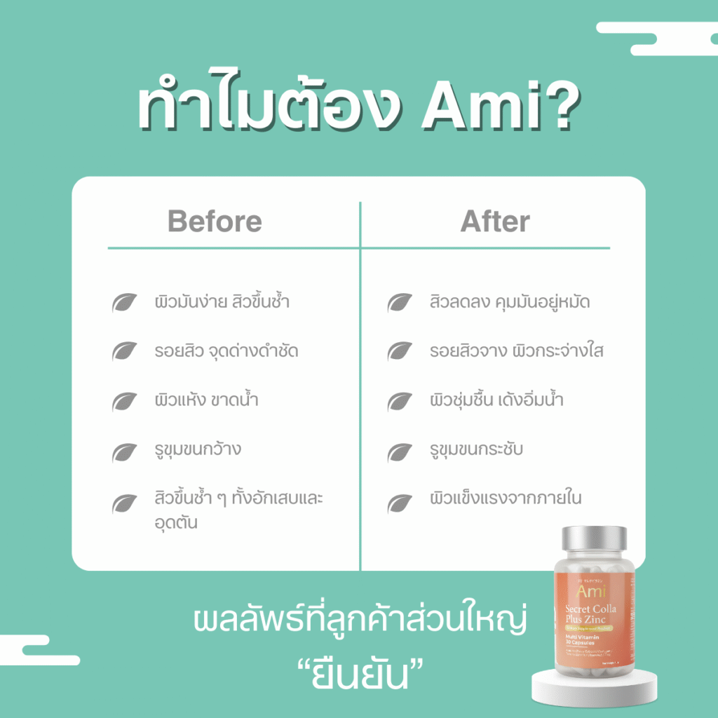 Ami Secret Colla Plus Zinc อาหารเสริมเพื่อผิวสวย ลดสิว รอยสิว บำรุงผิวใสสุขภาพดี