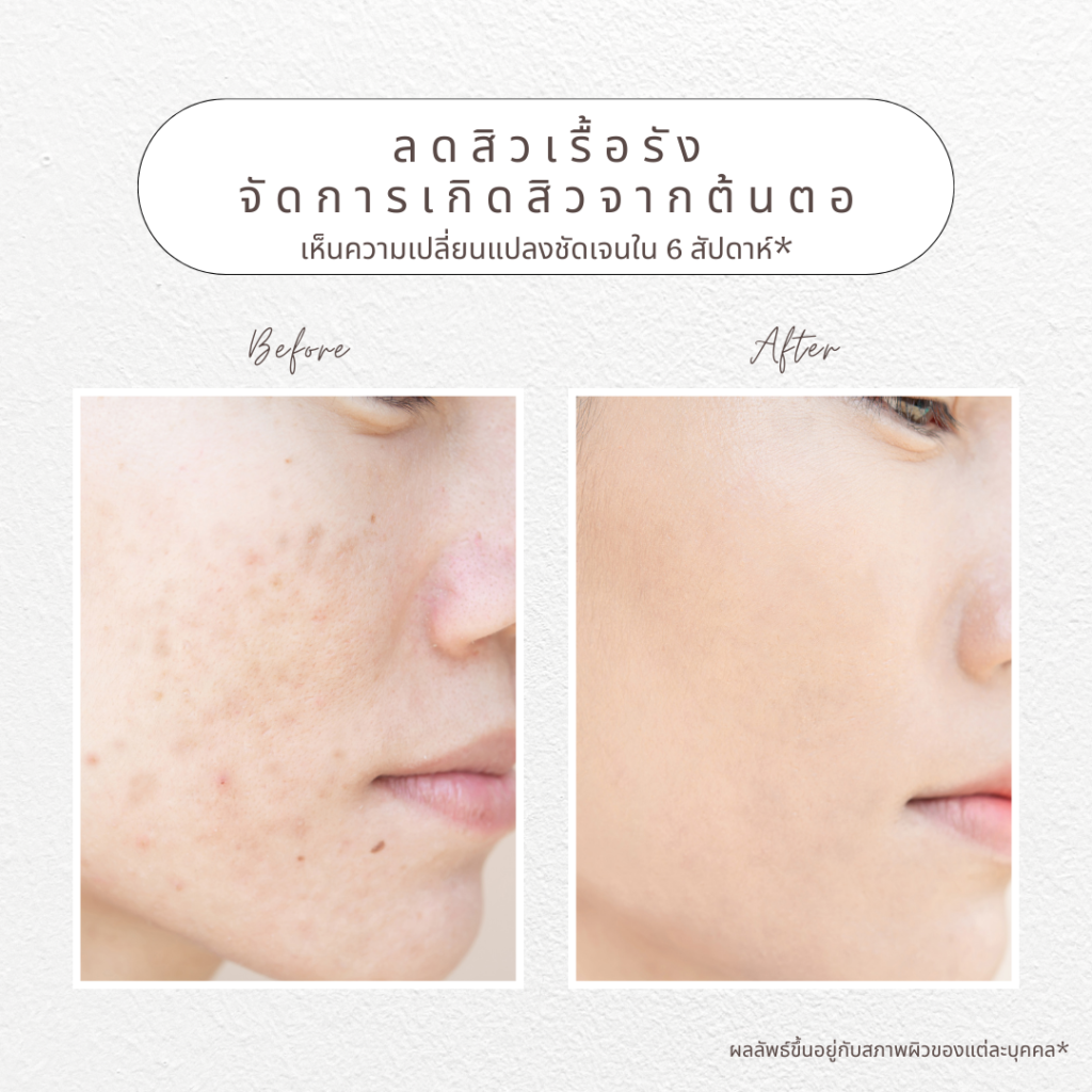 before after (1)